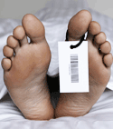 Dead feet